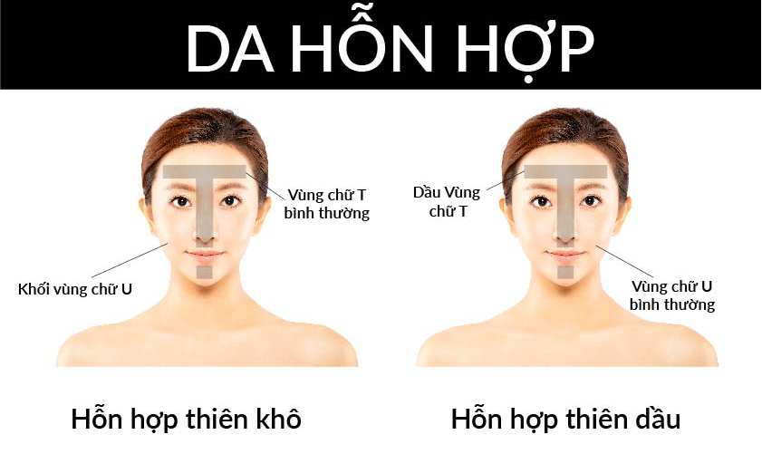 da hon hop la gi 02