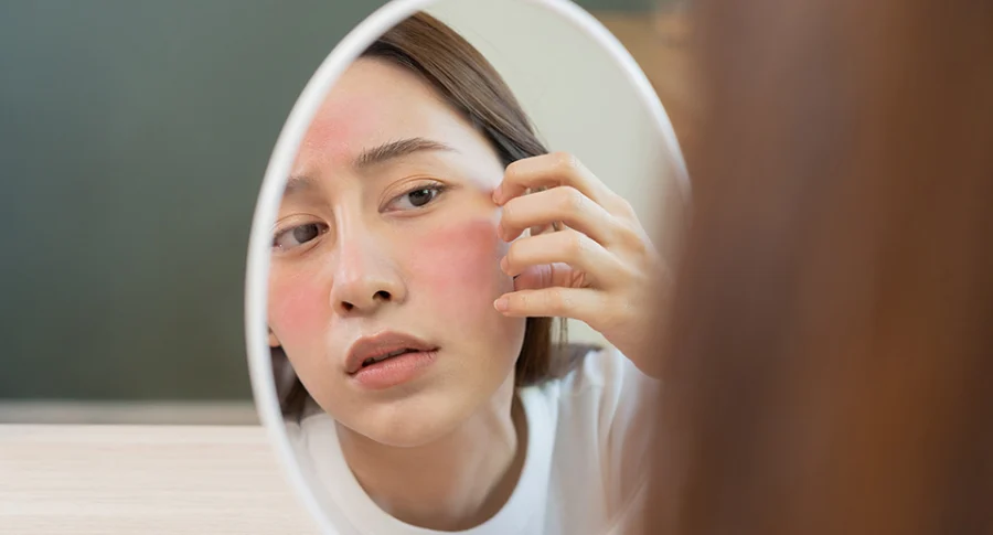 Da nhạy cảm nên dùng mỹ phẩm thế nào? Những thành phần cần lưu ý | Liên Botanica da nhay cam